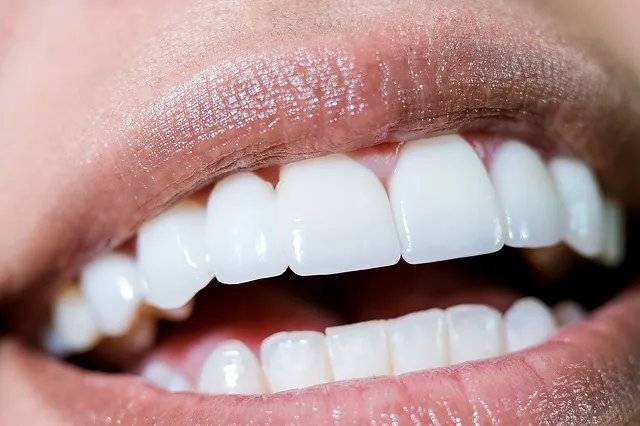 Image of really white teeth of a woman.